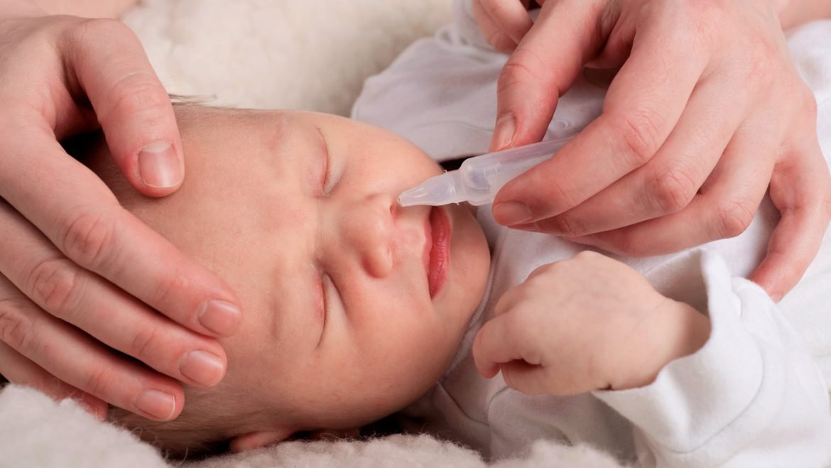 Obstrução nasal nos recém-nascidos
